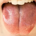 saliva